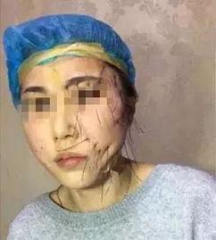 吃瓜抖音网红整容,吃瓜群众热议的美丽蜕变